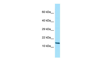 GCSH Rabbit Polyclonal Antibody
