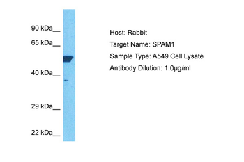 SPAM1 Rabbit Polyclonal Antibody