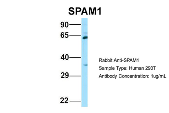 SPAM1 Rabbit Polyclonal Antibody