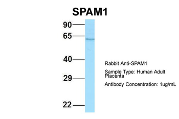 SPAM1 Rabbit Polyclonal Antibody