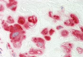 NEU2 Rabbit Polyclonal Antibody