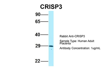 CRISP3 Rabbit Polyclonal Antibody