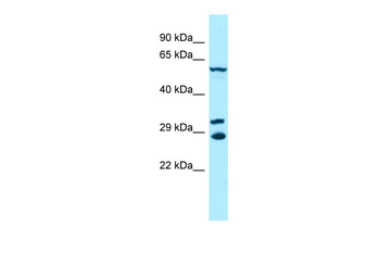 DYRK2 Rabbit Polyclonal Antibody