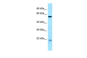 DYRK2 Rabbit Polyclonal Antibody