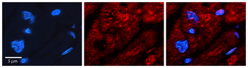 RPL11 Rabbit Polyclonal Antibody