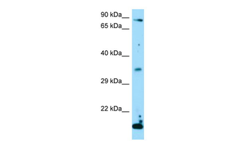 TSNAX Rabbit Polyclonal Antibody