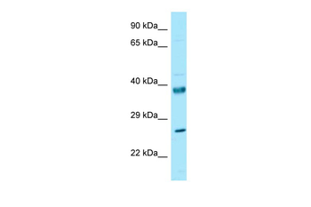 RPL10 Rabbit Polyclonal Antibody