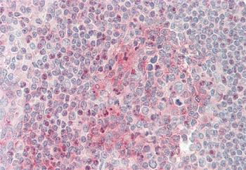 STXBP2 Rabbit Polyclonal Antibody