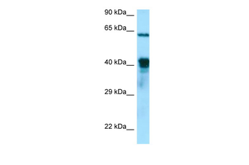 DNAJA3 Rabbit Polyclonal Antibody