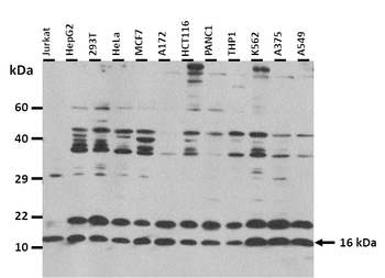 RPS17 Rabbit Polyclonal Antibody