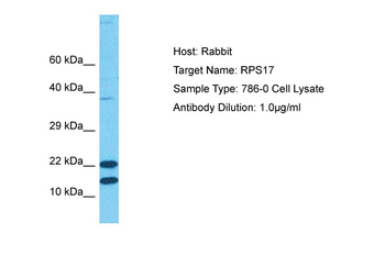 RPS17 Rabbit Polyclonal Antibody