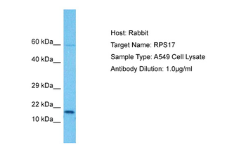 RPS17 Rabbit Polyclonal Antibody