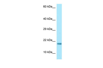 RPS17 Rabbit Polyclonal Antibody