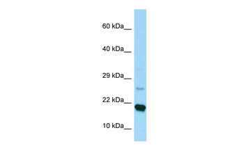 RPS17 Rabbit Polyclonal Antibody