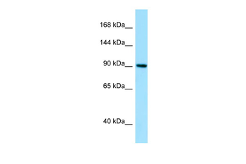 GBE1 Rabbit Polyclonal Antibody