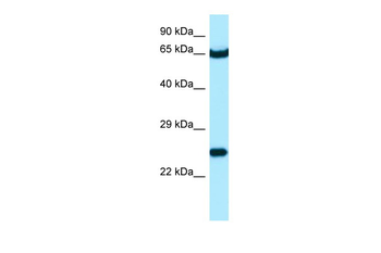 STXBP3 Rabbit Polyclonal Antibody