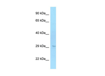 ELOVL6 Rabbit Polyclonal Antibody