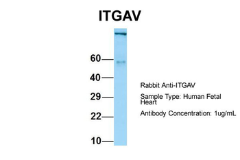 ITGAV Rabbit Polyclonal Antibody