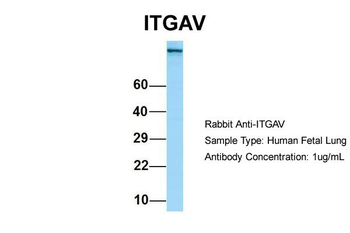 ITGAV Rabbit Polyclonal Antibody