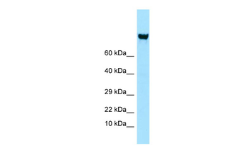ITGAV Rabbit Polyclonal Antibody