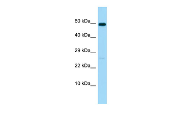MMP17 Rabbit Polyclonal Antibody