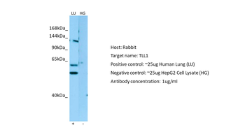 TLL1 Rabbit Polyclonal Antibody