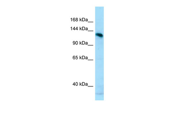 AMPD2 Rabbit Polyclonal Antibody