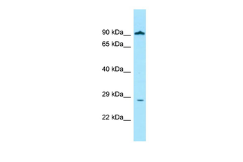 GLIPR1 Rabbit Polyclonal Antibody