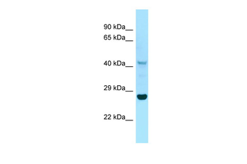 IDO1 Rabbit Polyclonal Antibody