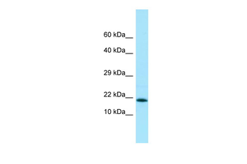 UBE2V2 Rabbit Polyclonal Antibody
