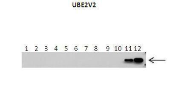 UBE2V2 Rabbit Polyclonal Antibody