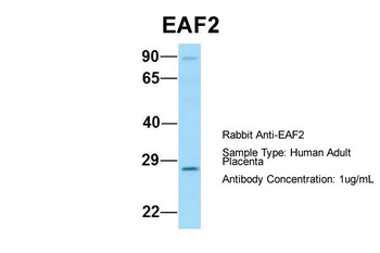 EAF2 Rabbit Polyclonal Antibody