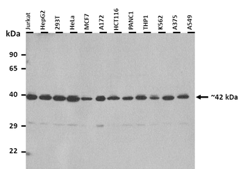GNA11 Rabbit Polyclonal Antibody