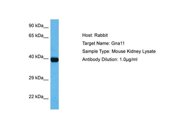 GNA11 Rabbit Polyclonal Antibody