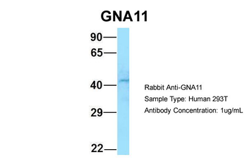 GNA11 Rabbit Polyclonal Antibody