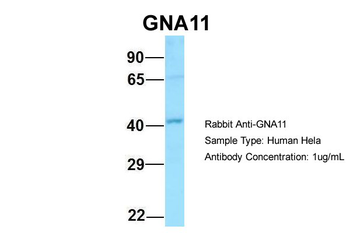 GNA11 Rabbit Polyclonal Antibody