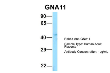 GNA11 Rabbit Polyclonal Antibody