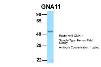 GNA11 Rabbit Polyclonal Antibody