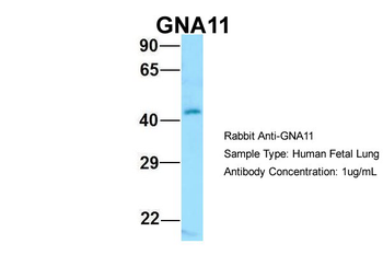 GNA11 Rabbit Polyclonal Antibody