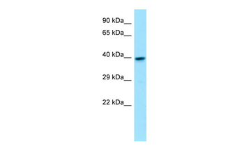 GNA11 Rabbit Polyclonal Antibody
