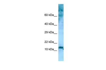 RPL36 Rabbit Polyclonal Antibody