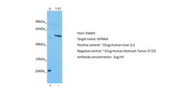 GPM6A Rabbit Polyclonal Antibody