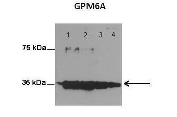 GPM6A Rabbit Polyclonal Antibody