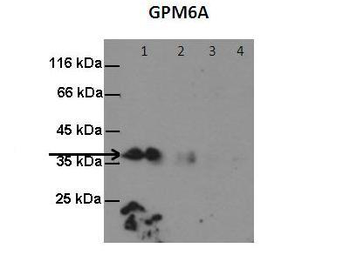 GPM6A Rabbit Polyclonal Antibody