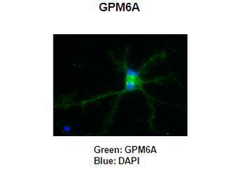 GPM6A Rabbit Polyclonal Antibody