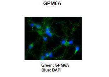 GPM6A Rabbit Polyclonal Antibody