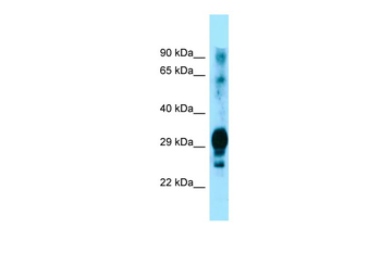GPM6A Rabbit Polyclonal Antibody