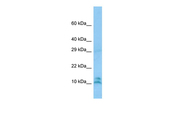 LALBA Rabbit Polyclonal Antibody