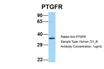 PTGFR Rabbit Polyclonal Antibody