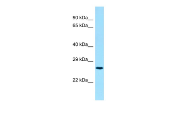 BIN3 Rabbit Polyclonal Antibody